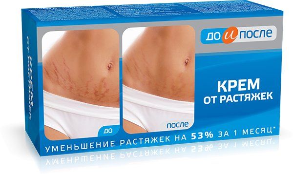 Изображение товара До и после крем от растяжек 100 мл До и после крем от растяжек 100 мл фотография